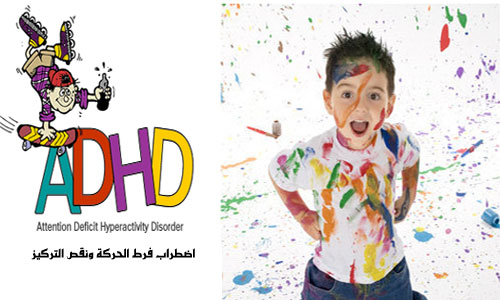 متلازمة ADHD عند الأطفال
