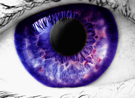 متلازمة العيون البنفسجية