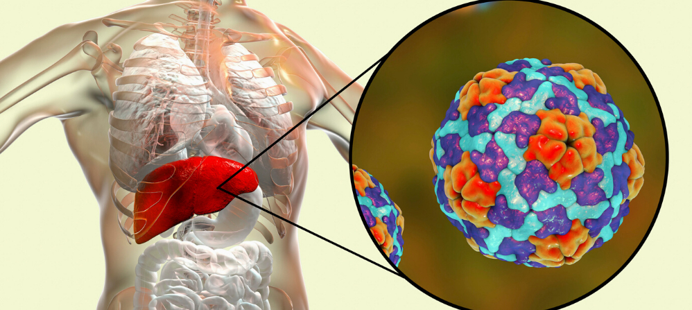 ما سبب التهاب الكبد الوبائي؟